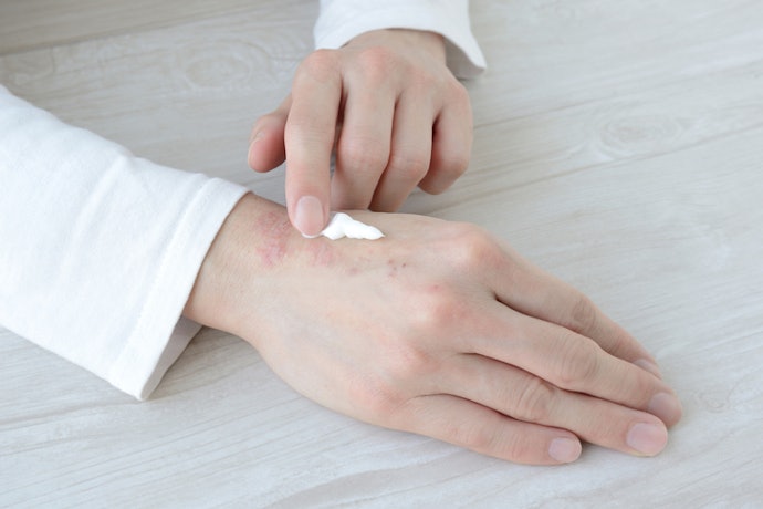 For Eczema-Prone Skin, Prioritize Thick, Gentle, and Fragrance-Free Hand Creams