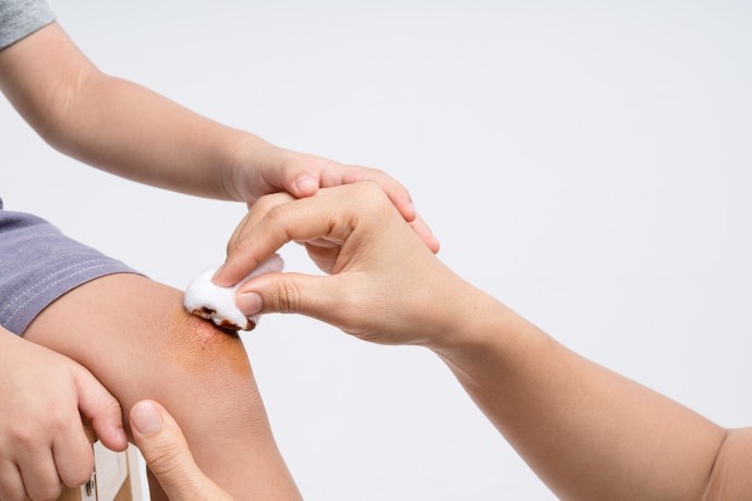 Povidone-Iodine or Chlorhexidine: For Effective Disinfection but May Delay Healing if Overused