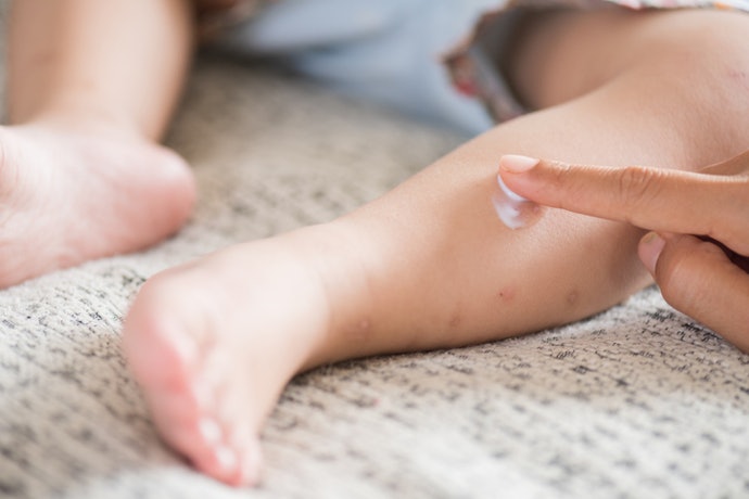 Avoid Fragrances and Dyes to Reduce Allergic Reactions