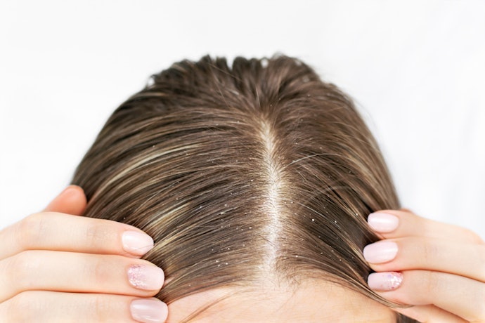 Sensitive or Flaky Scalp: Jojoba Oil for Balance and Soothing