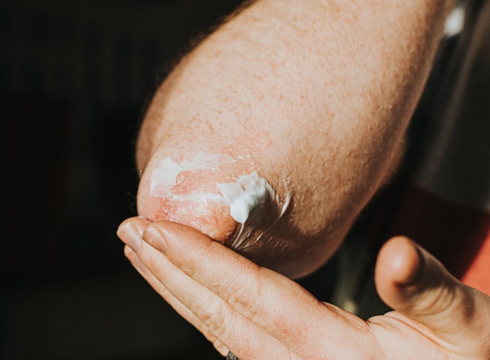 Milder Formulations for Sensitive Skin