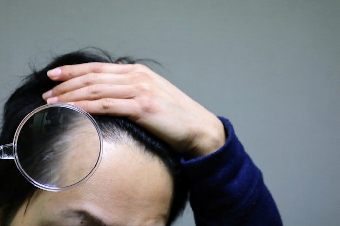 For Diffuse Thinning and Weak Follicles: Choose Vitamin D3 and Zinc
