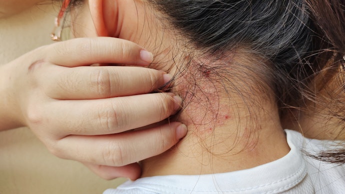 For the Scalp: Look for Residue-Free Creams or Lotion-Like Textures That Won’t Weigh Down Hair