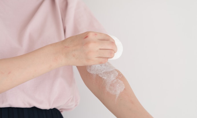Fragrances Can Trigger Allergies