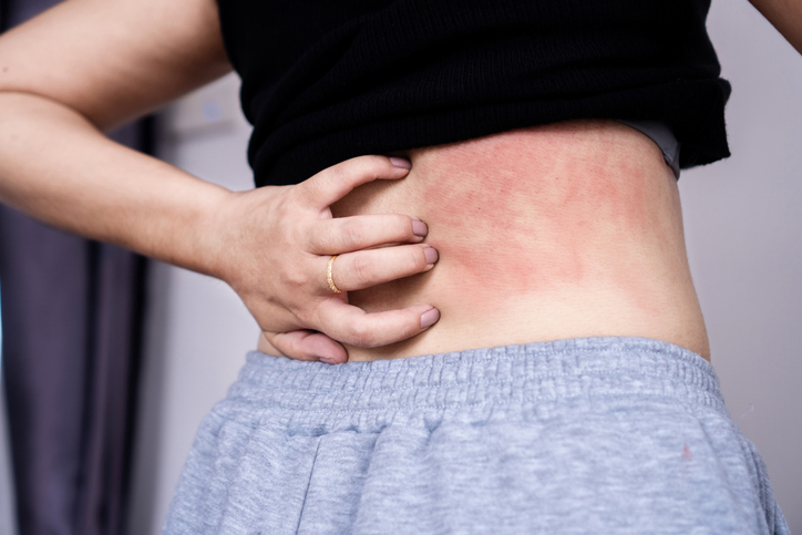 10 Best Antihistamines in the Philippines 2026 | Buying Guide Reviewed ...