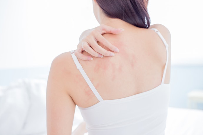 To Calm Itch, Redness, and Irritation: Soothing Ingredients Like Aloe Vera, Oatmeal, and Niacinamide