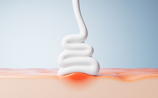 For Sudden Breakouts, Spot Treatments Deliver Fast Relief