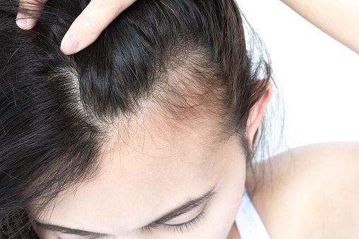 For Fine or Thin Hair: Lightweight Oils Prevent Flatness and Greasiness