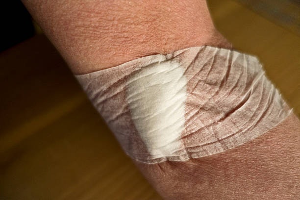 For Dry or Damaged Skin: Use Moisture-Retentive Dressings Like Hydrogel