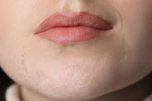 For Dry or Combination Skin: Look for Hydrating Toners to Lock in Moisture