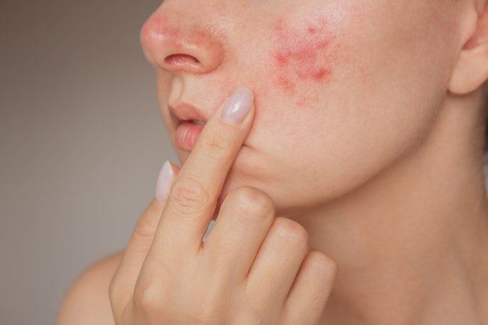 For Acne-Prone Skin: Jojoba Oil Blended With Tea Tree Oil Helps Prevent Breakouts