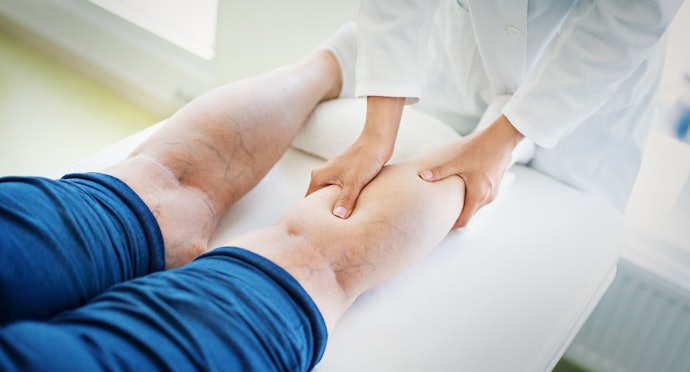 Go for 30–40 mmHg for Serious Leg Symptoms