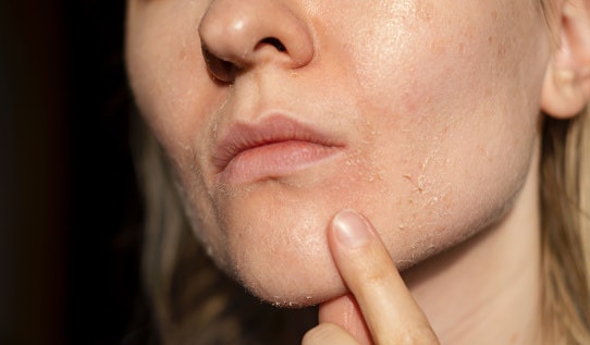 Moisture-Rich Ingredients for Restoring and Repairing Dry Skin