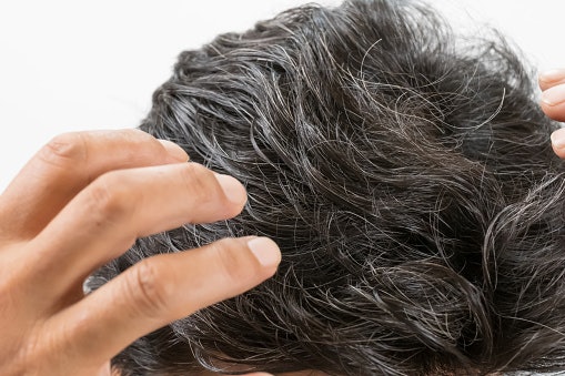 Permanent Dye for Long-Lasting Gray Coverage