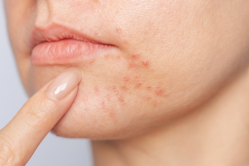 For Calming Skin: Soothing Serums With Centella Asiatica, Mugwort, or Heartleaf