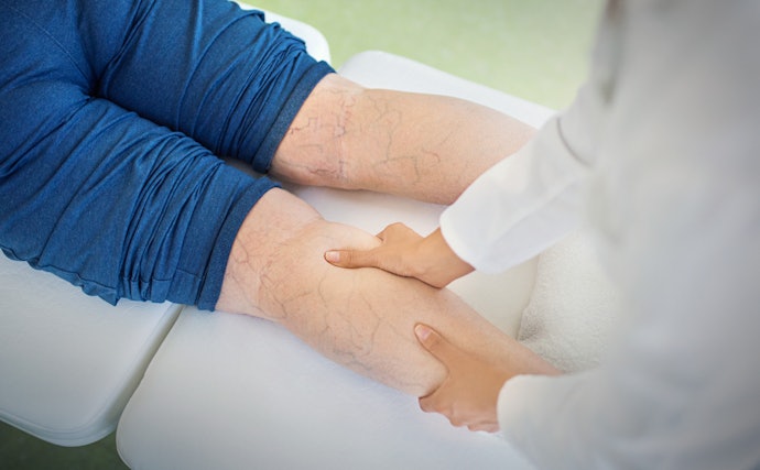 For Mild Symptoms, Use 20–30 mmHg of Compression for Your Socks