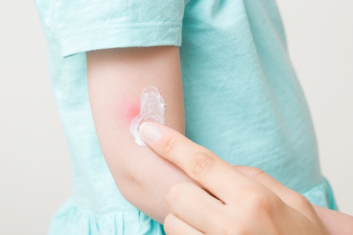 Lidocaine or Pramoxine: Provides Fast Pain and Itch Relief