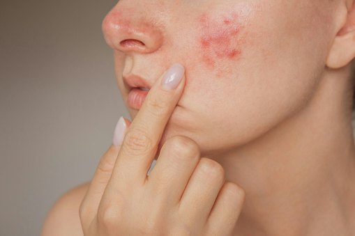 For Redness and Reactivity: Calm Skin With Centella or Chamomile-Based Serums