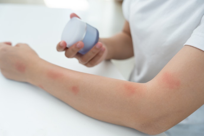 For Existing Redness or Wounds: Select a Healing Cream