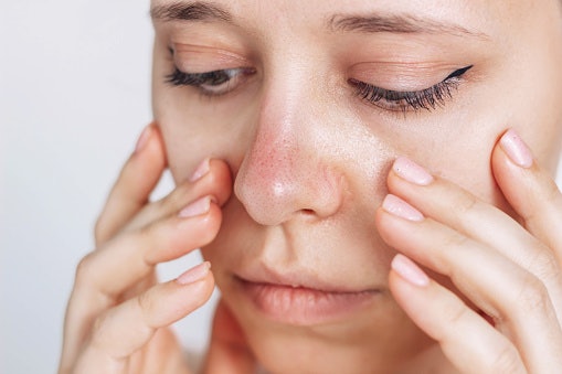 Niacinamide Calms Redness and Balances Oil Production