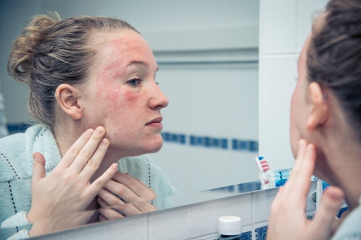 For Sensitive Skin: Avoid BB Creams With Fragrances and Harsh Chemicals