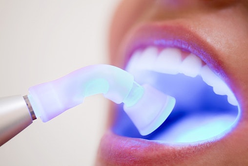 Speed Up the Whitening Process With Blue LED Technology
