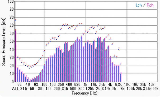 Clear and Reliable Microphone Performance for Calls