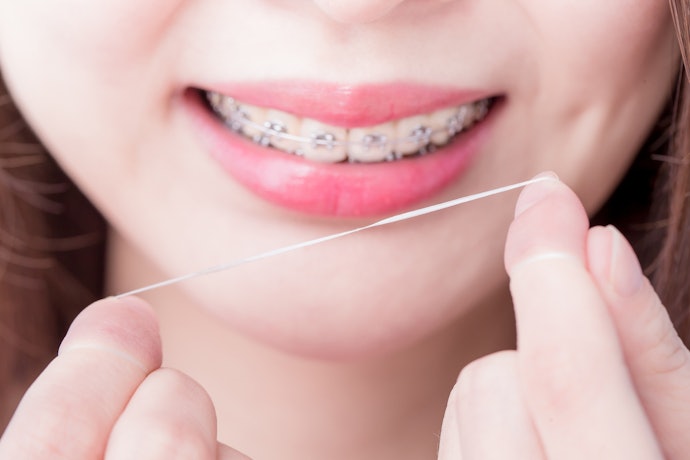 A Super Floss Is Ideal for Braces, Bridges, and Wide Gaps