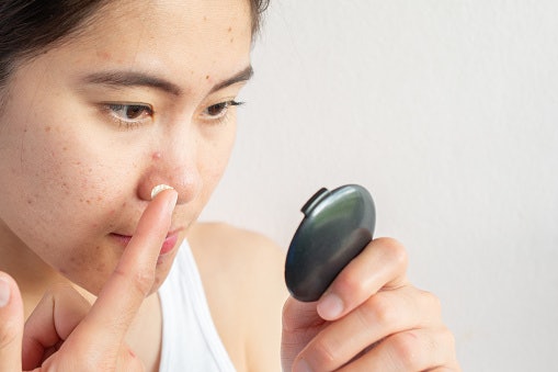 For Acne-Prone and Oily Skin: Opt for an Oil-Free Formula With a Matte Finish