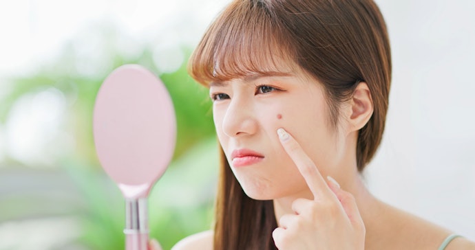 Medicated Patches for Inflammatory or Red and Swollen Pimples