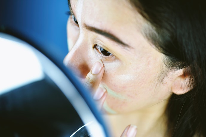 Green Corrects Redness From Acne or Rosacea