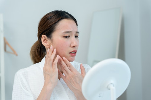 Fight Persistent Breakouts With Clindamycin or Erythromycin
