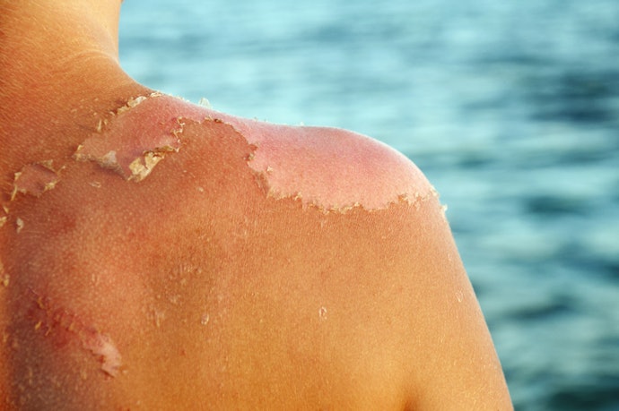 For Preventing Peeling and Long-Term Dryness: Barrier-Repairing Ingredients Such as Ceramides, Panthenol, Shea Butter