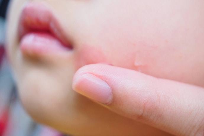 Avoid Using Skin-Only “Soothing” Products Inside the Mouth