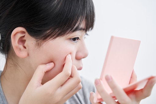 For Oily or Acne-Prone Skin: Choose Foam or Gel Cleansers With Oil-Control or Acne-Care Actives