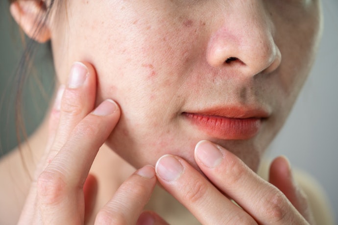 Avoid Irritation and Clogged Pores With Alcohol- and Silicone-Free Face Mist